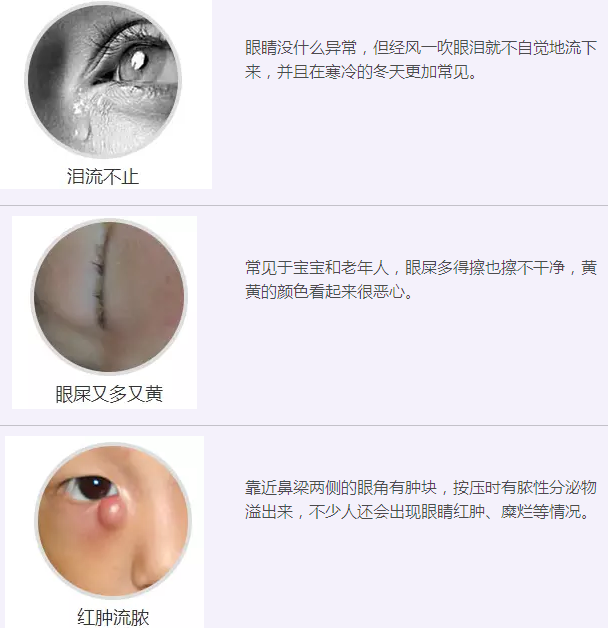 12月17日，普瑞集團淚道專家來疆親診，預(yù)約請速！