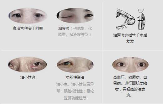 12月17日，普瑞集團淚道專家來疆親診，預(yù)約請速！