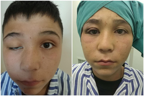 公益活動進行時，9月20日4名被救助孩子接受手術(shù)