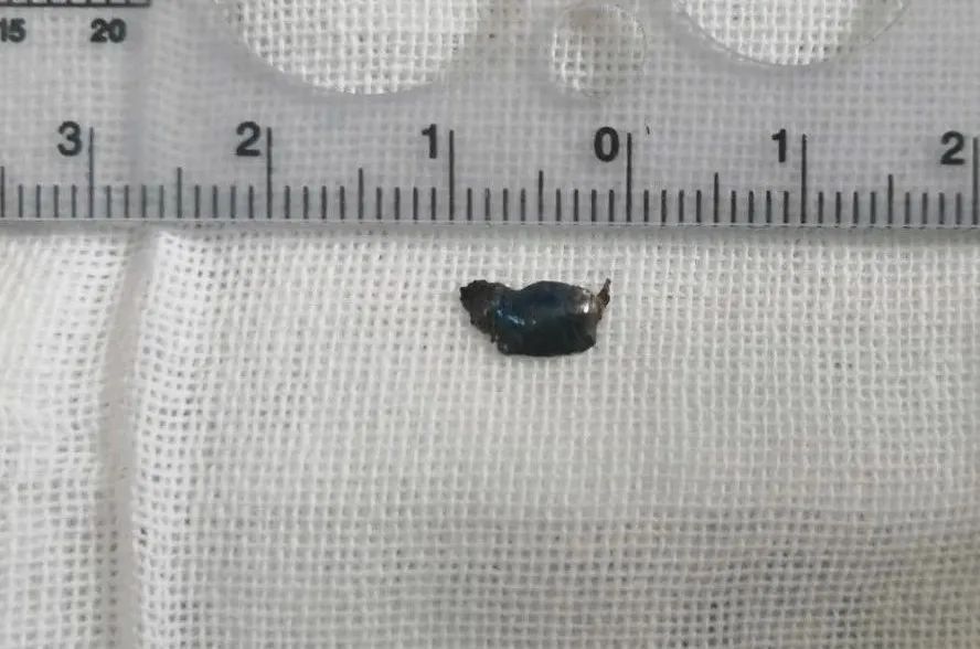 戰(zhàn)“疫”紀實|一臺從市長熱線開始的急診手術 