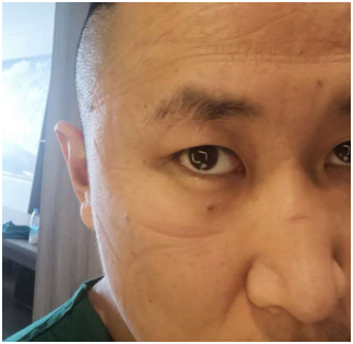 來時(shí)無畏，不勝不歸—楊醫(yī)生抗疫日記(2)